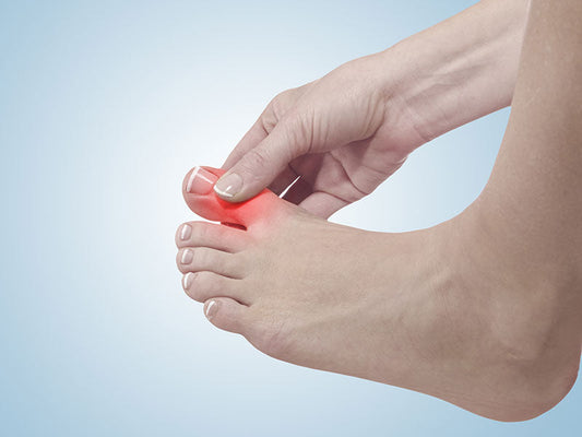Hallux Rigidus Treatment