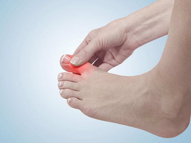 Hallux Rigidus Treatment