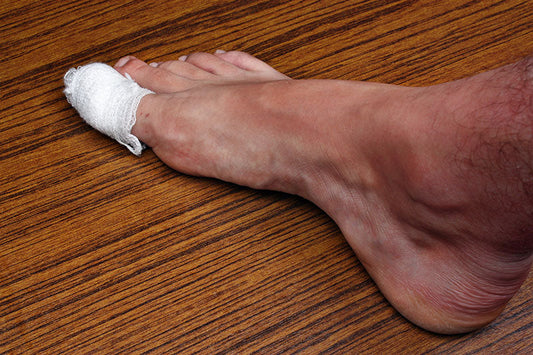 Runners And The Issue Of Toenail Loss
