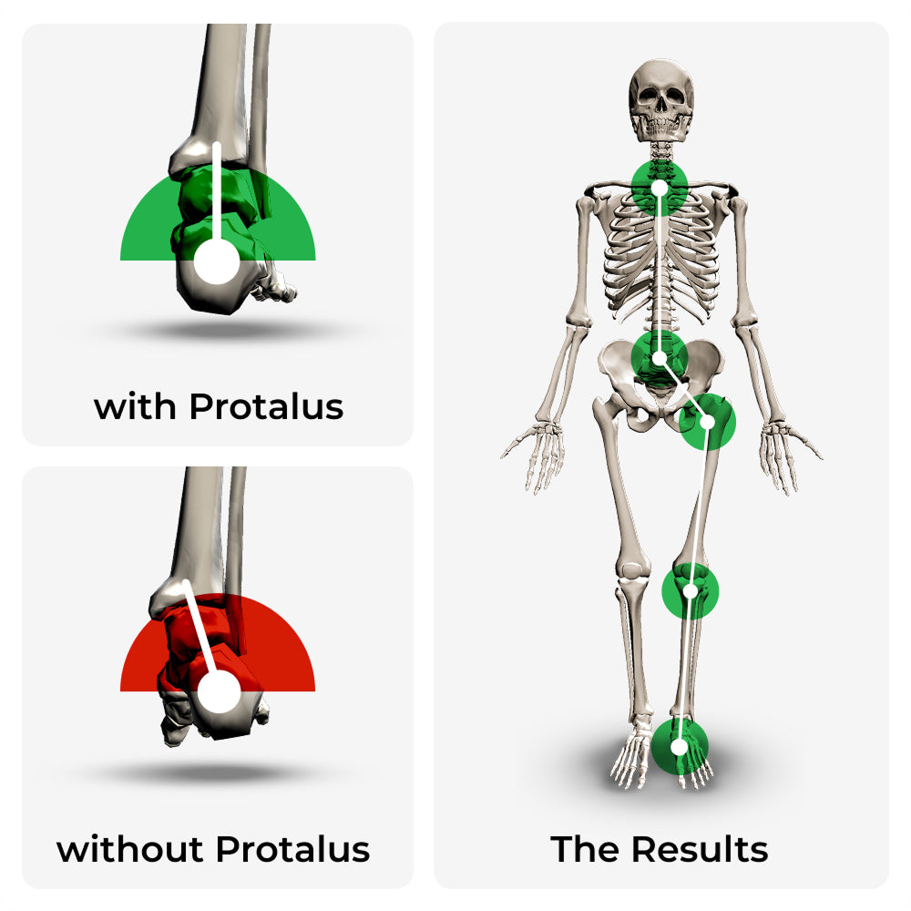 Protalus Insoles For Pain Relief & Comfort | Protalus