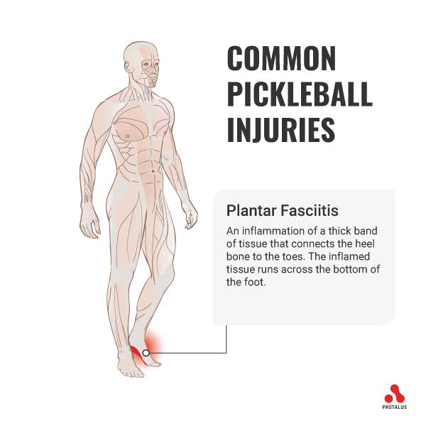 Plantar Fasciitis