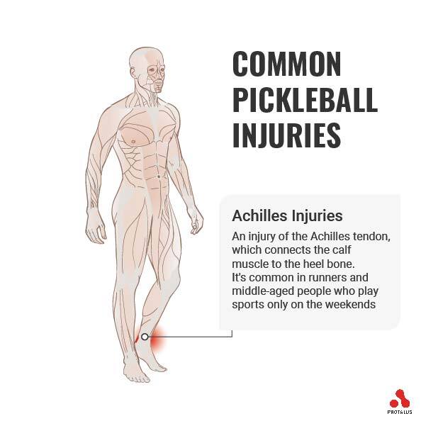 Achilles Injuries