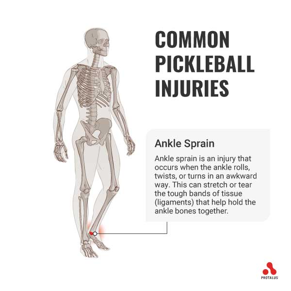 Ankle Sprain